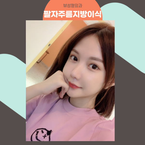 팔자주름지방이식 으로 젊어지자! 관련 이미지 7