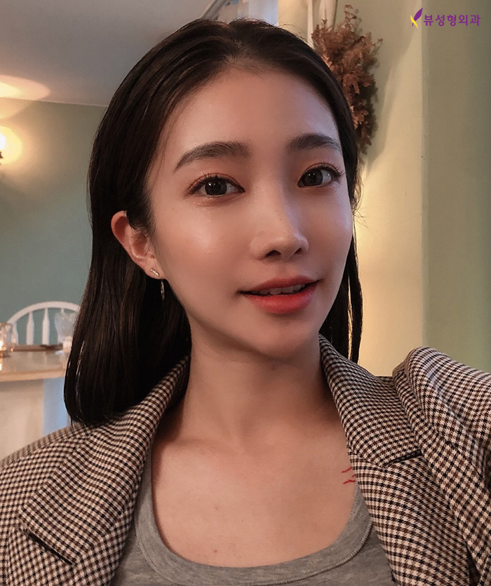 안면윤곽성형 황금비율 찾는 사각턱성형이 필요해 관련 이미지 4