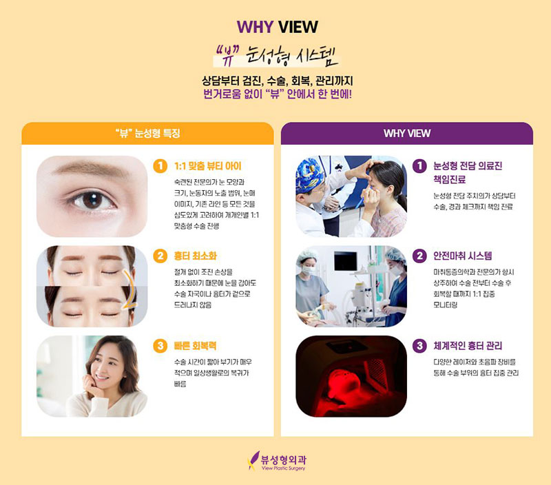 내게 맞는 눈성형을 위한 수술방법 관련 이미지 16