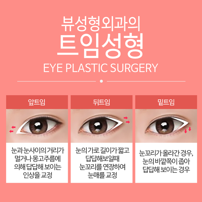 뷰성형외과 트임성형수술로 예쁨 충전 완료&hearts; 관련 이미지 4