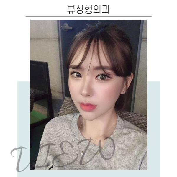 쌍꺼풀수술종류 알아보기 관련 이미지 6