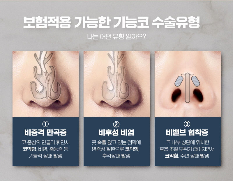 비염코수술 코막힘 줄이려면 관련 이미지 3