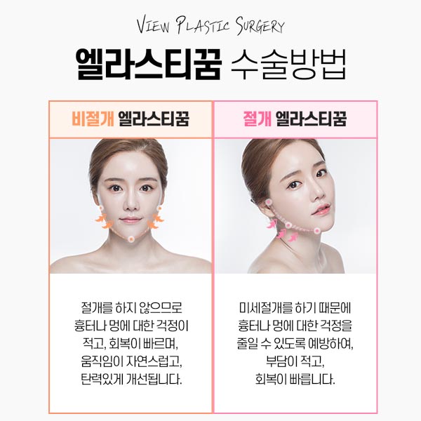 동안 얼굴의 비결! 엘라스티꿈 관련 이미지 9