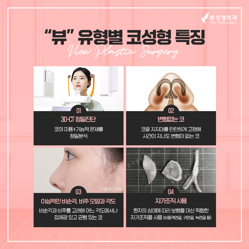 짧은코성형, 뷰에서 뷰티풀하게 관련 이미지 4