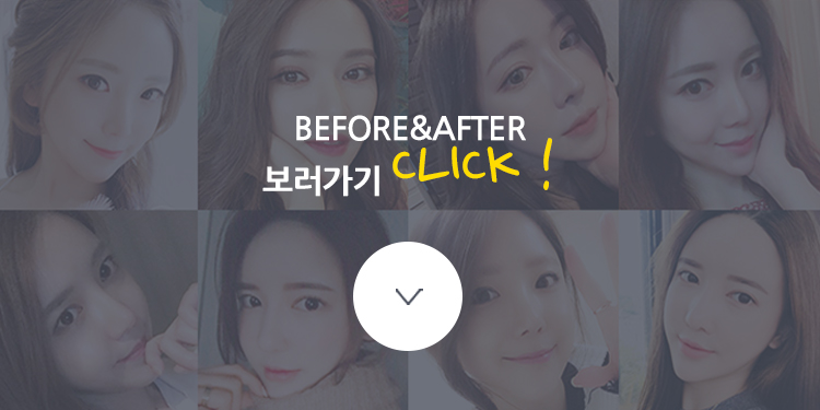 양악수술 갸름한 얼굴과 자연스러운 표정 원한다면 관련 이미지 4