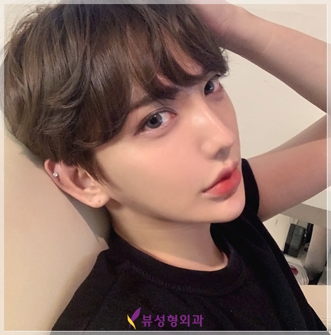 강남코재수술 하면 뷰성형외과지★ 관련 이미지 4