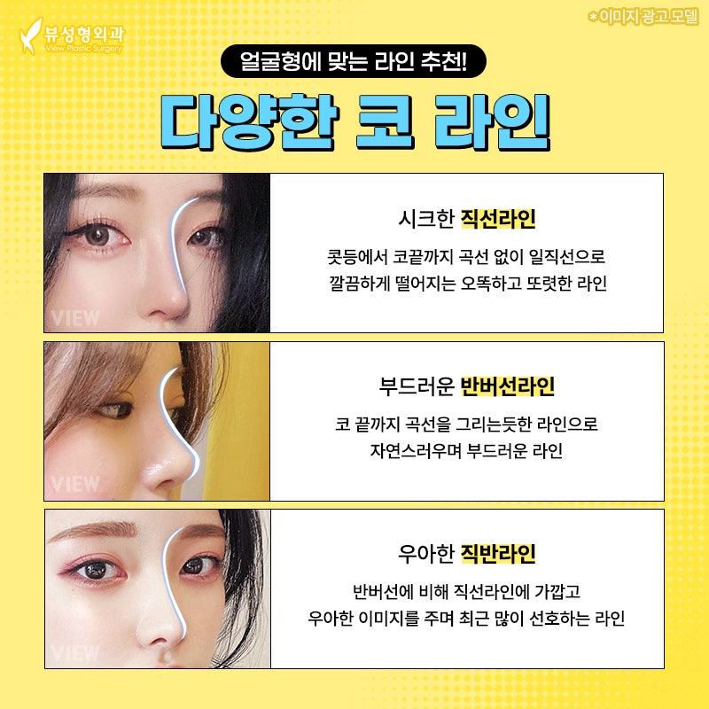 코성형, 개인별 유형에 적합한 수술방법은? 관련 이미지 3