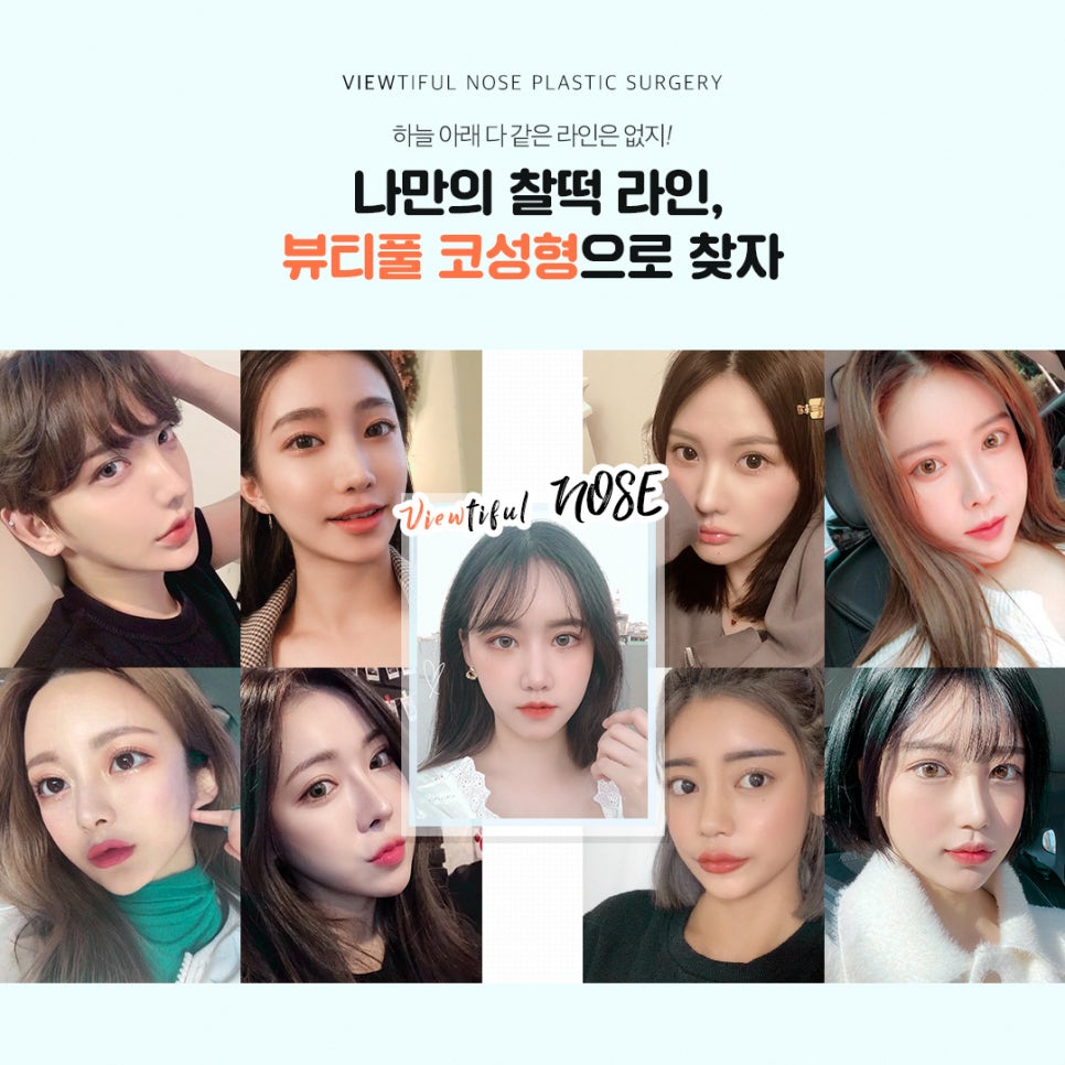 코수술 전후, 맞춤성형 뷰성형외과 관련 이미지 8