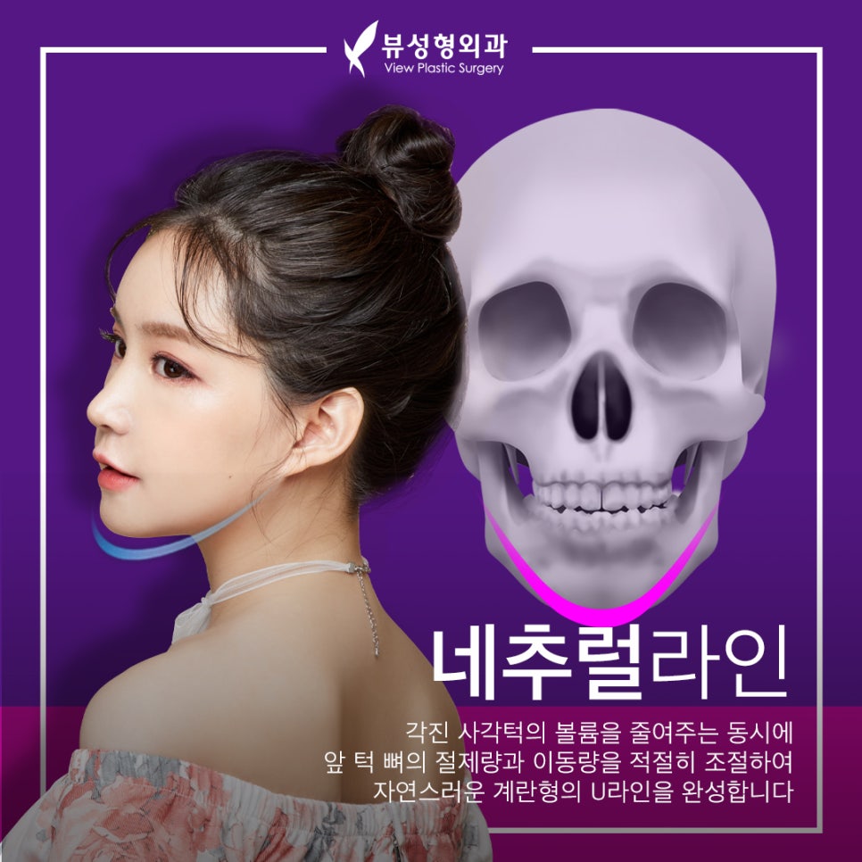 얼굴형의 밸런스를 맞춰주는 안면윤곽수술 관련 이미지 10