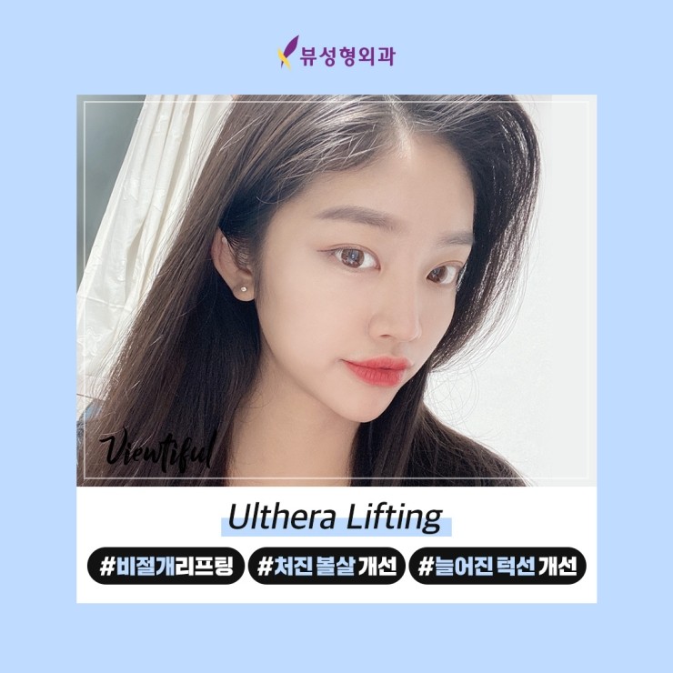 [알림] ★☆ 울쎄라이벤트 놓치지 마세요! (~20.04.30까지) ★☆ 관련 이미지 5