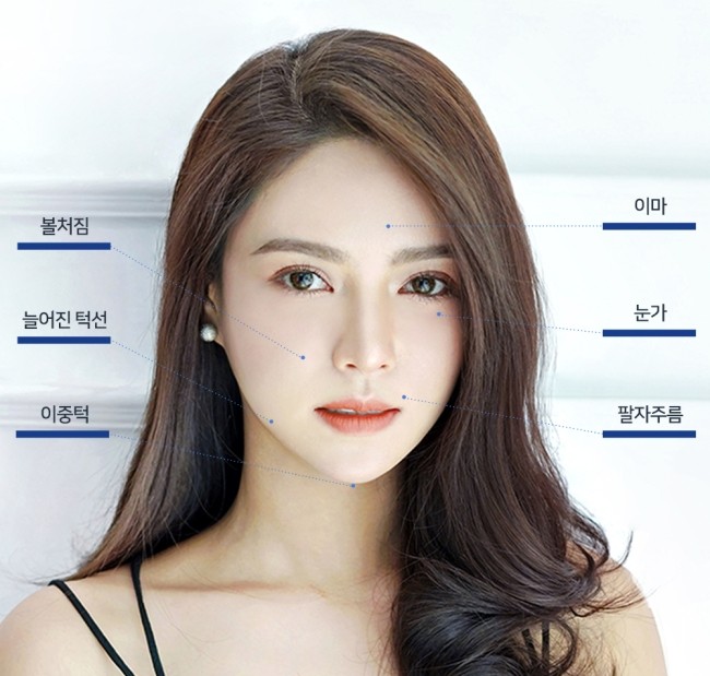 실리프팅 VS 안면거상술, 피부 상태에 맞는 맞춤리프팅 관련 이미지 6