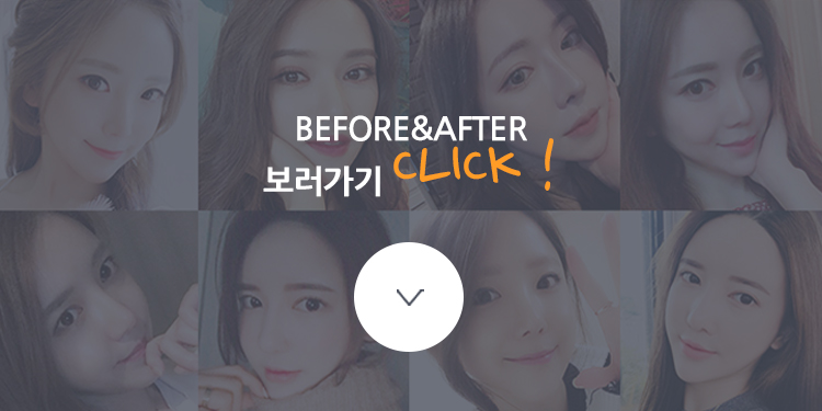 VIEW만의 콤비매몰로 또렷한 눈매 완성 관련 이미지 4