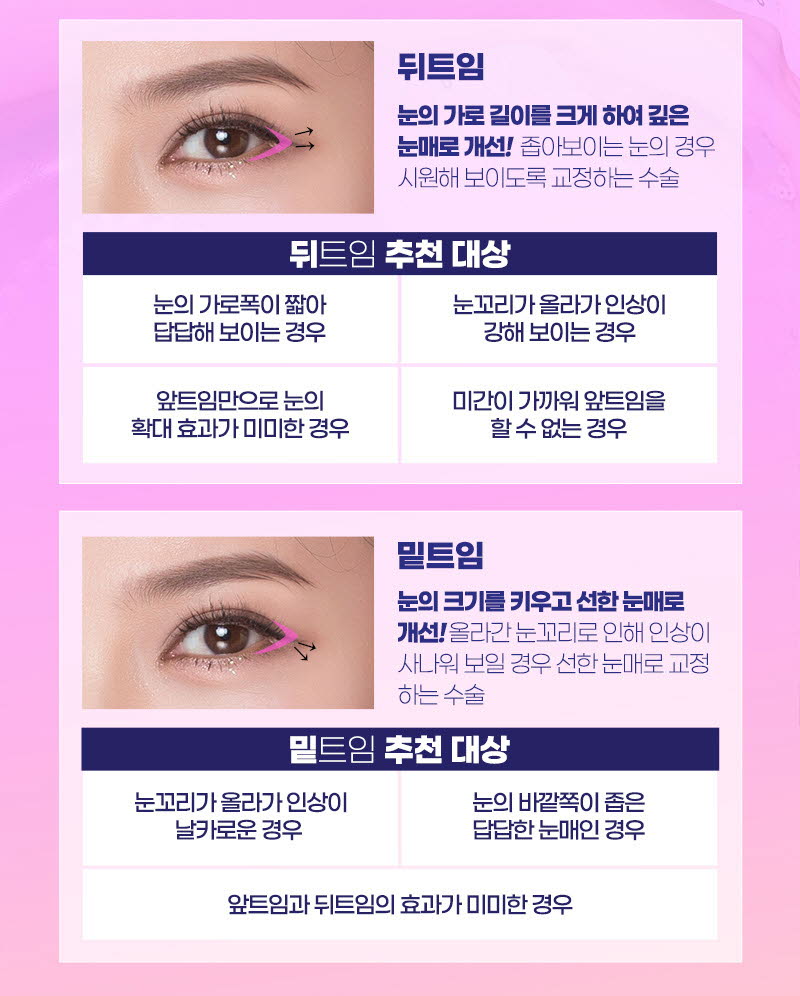 뒤트임가격 만큼 중요한 부분 관련 이미지 3