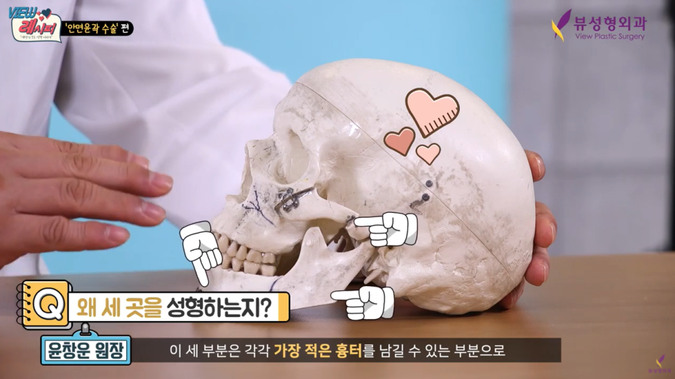 남자안면윤곽 새로운 변화를 원한다면 관련 이미지 4