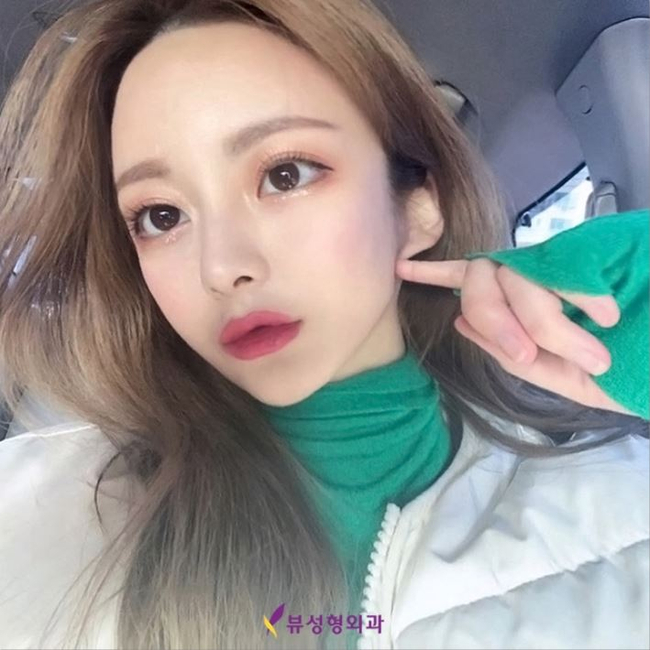 눈매교정수술전후 차이를 더 또렷하게 관련 이미지 8