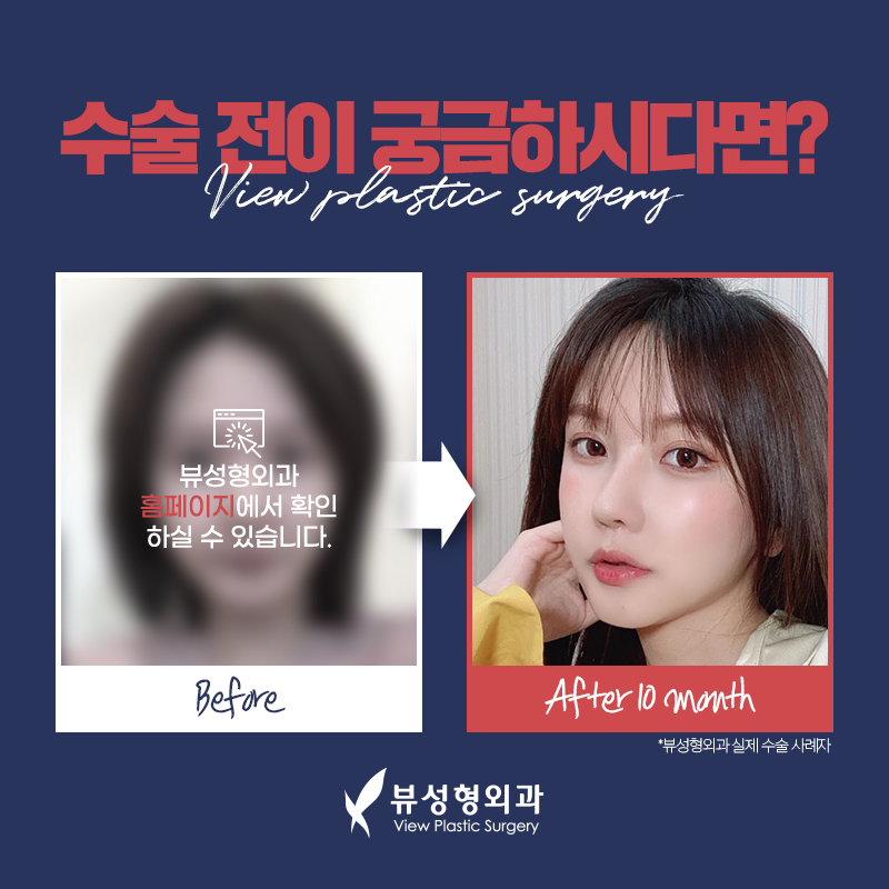 윤곽수술비용보다 안전성을 꼼꼼히 따져야 관련 이미지 20