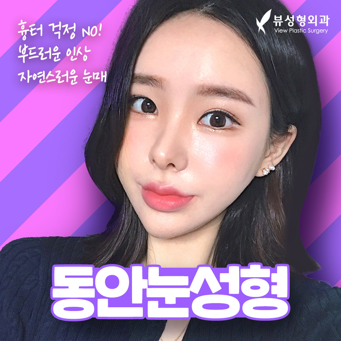 나만의 눈성형을 위한 수술방법 알아보기 관련 이미지 16