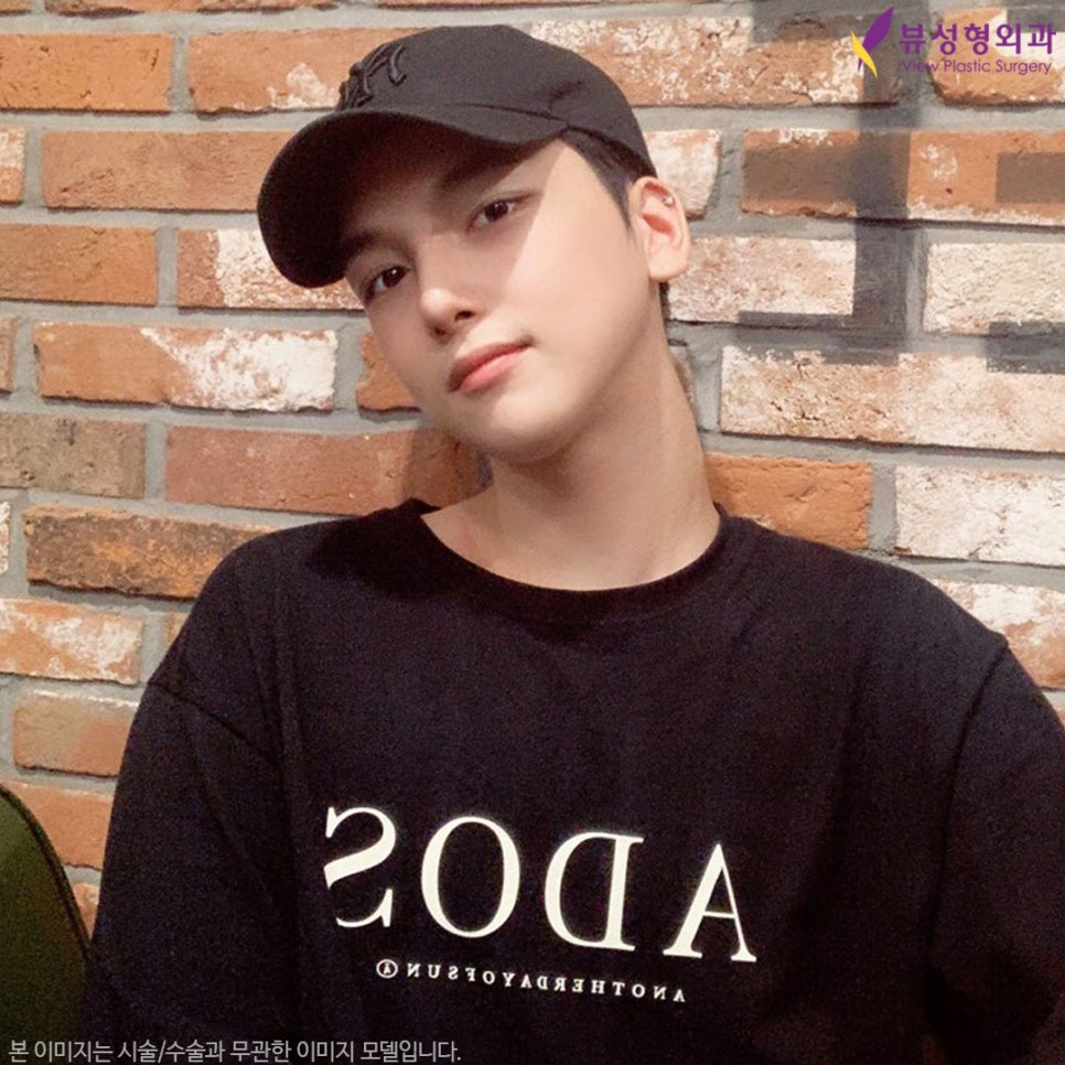 안면윤곽수술회복기간 제대로 알아보자 관련 이미지 5