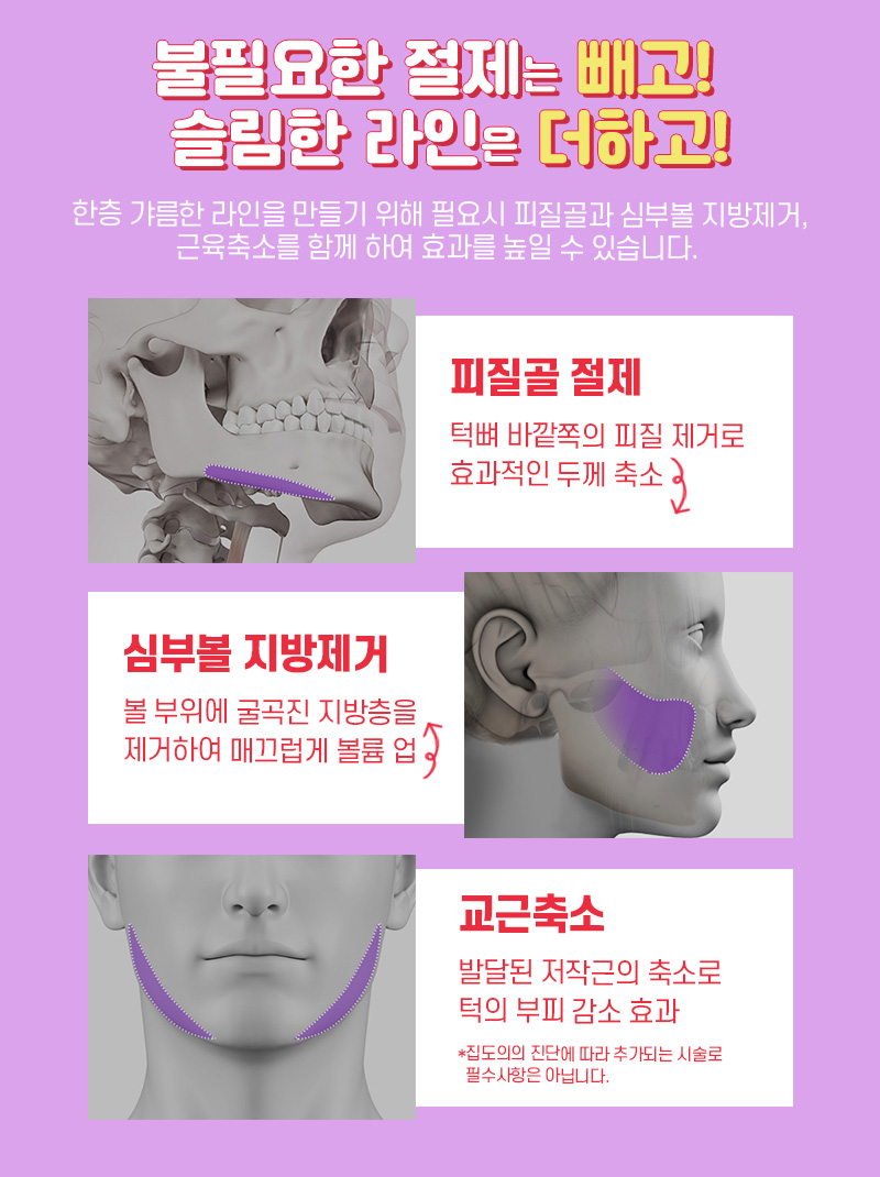 안면윤곽후기 뼈 상태를 위주로 관련 이미지 8