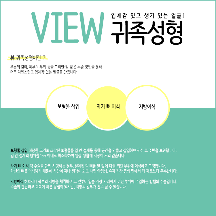 생기 있는 동안 얼굴 비밀은? 귀족성형 관련 이미지 3