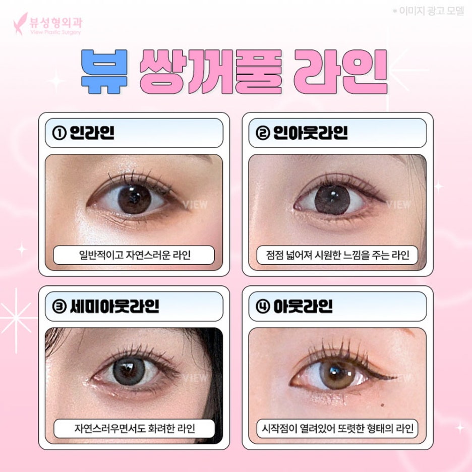 Exploring the Right Eye Plastic Surgery Options for Me image 6