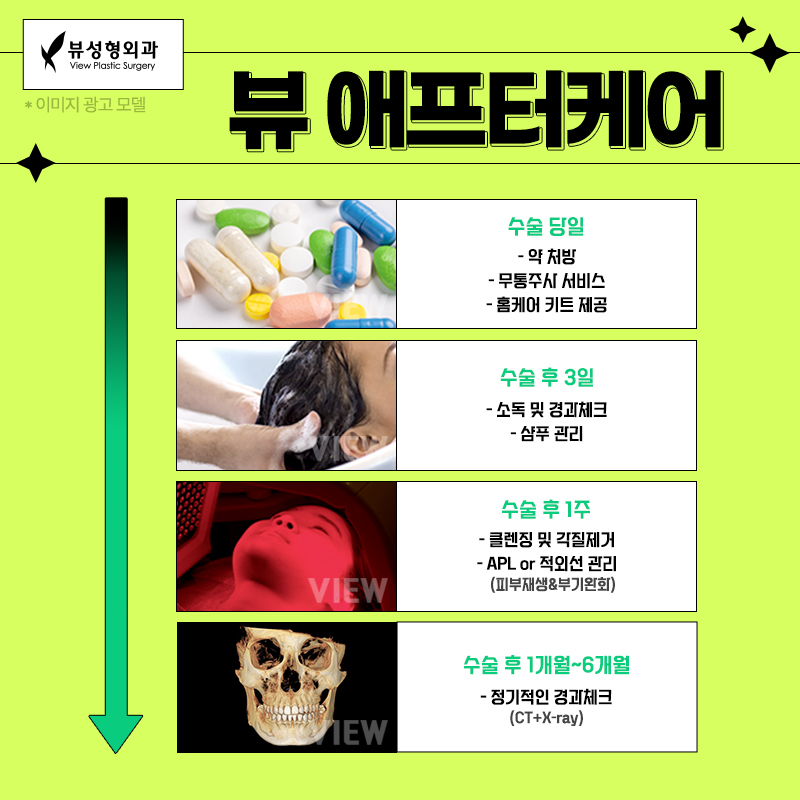 얼굴형의 밸런스를 맞춰주는 안면윤곽수술 관련 이미지 11