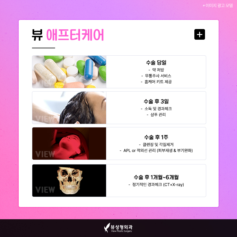 얼굴형의 밸런스를 맞춰주는 안면윤곽수술 관련 이미지 11