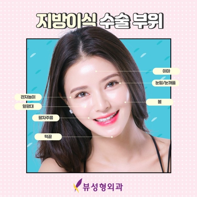 밋밋한 얼굴을 볼륨감 있게 입체적으로 개선하는 지방이식 관련 이미지 5