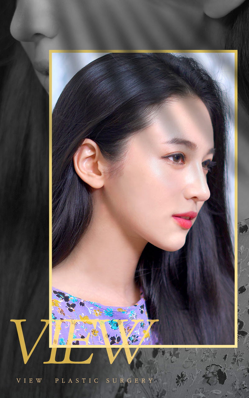 코재수술후기 꼼꼼하게 따져 보아야 할 점은 관련 이미지 2