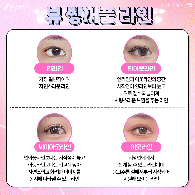 내게 맞는 눈성형 알아보기 관련 이미지 8