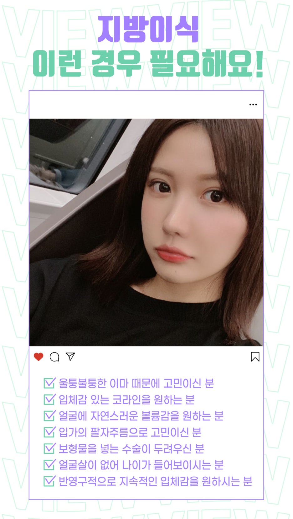 밋밋한 얼굴을 볼륨감 있게 입체적으로 개선하는 지방이식 관련 이미지 6