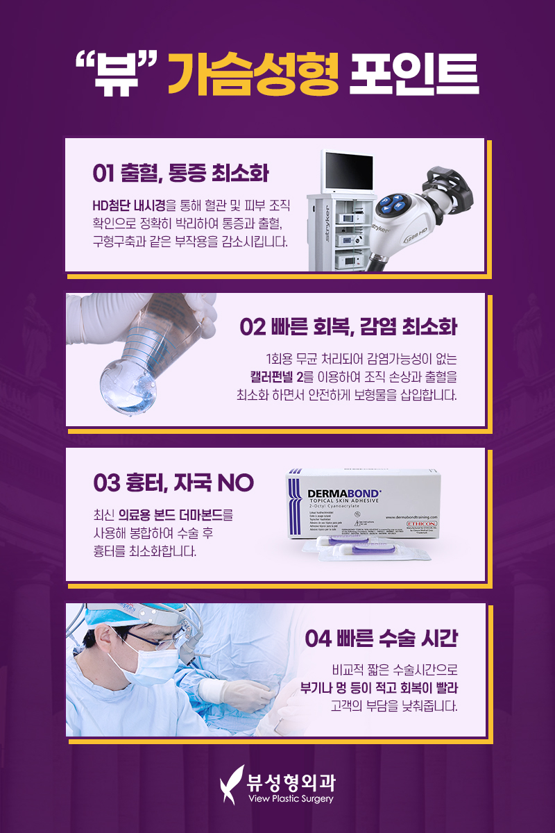 뷰성형외과 보형물 삽입을 통한 가슴성형후기 관련 이미지 13