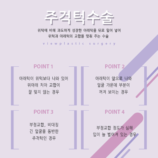 주걱턱수술, 만족도 높은 결과를 위한다면? VIEW! 관련 이미지 3