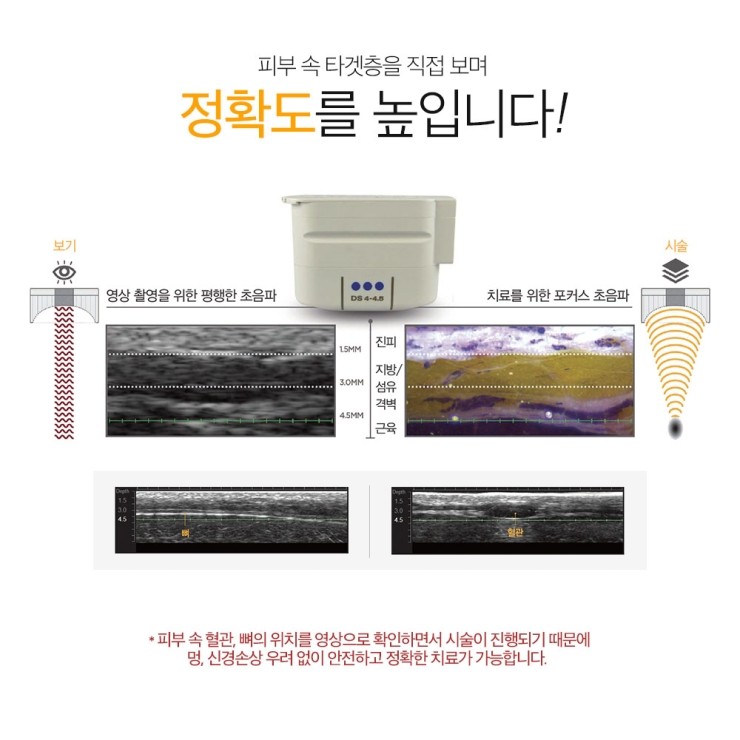 [알림] ★☆ 울쎄라이벤트 놓치지 마세요! (~20.04.30까지) ★☆ 관련 이미지 3