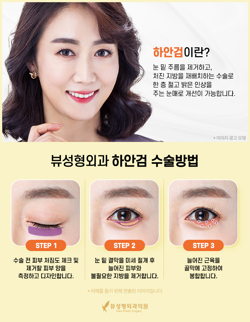 처지고 주름진 피부를 개선하는 동안성형 관련 이미지 7