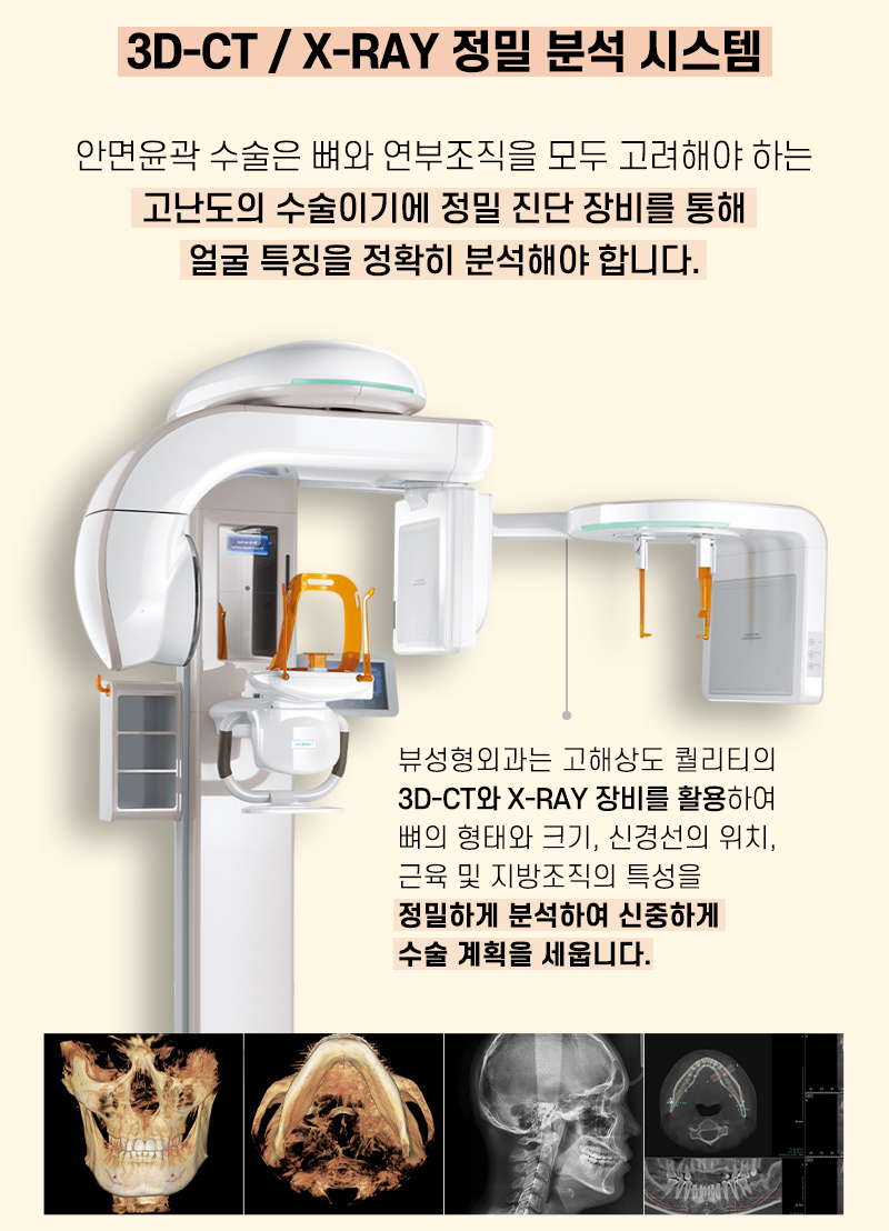 안면윤곽수술 고민하고 있다면 관련 이미지 9