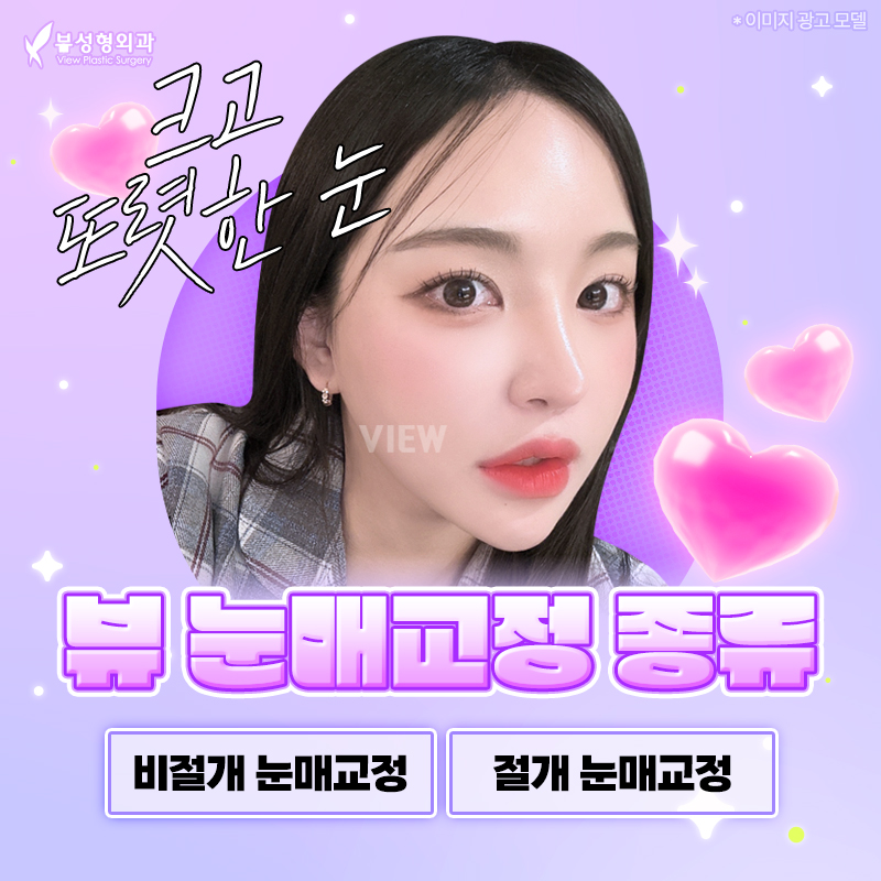 내게 맞는 눈성형 알아보기 관련 이미지 13