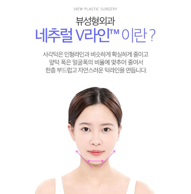 안면윤곽성형외과 보다 나아진 인상을 관련 이미지 6