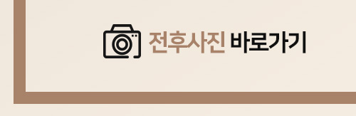 자연스런 가슴성형, 본인에게 적합한 보형물 및 절개방법 선택 중요 관련 이미지 4