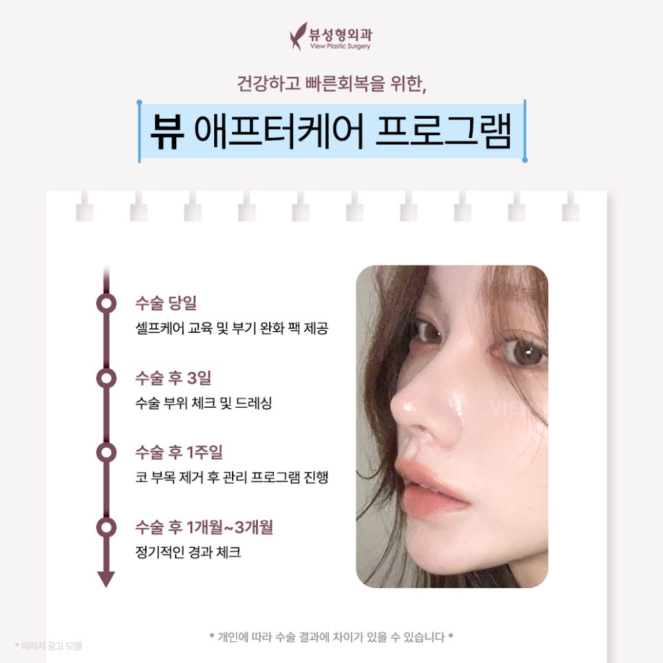 예쁘고 건강한 코, 비염치료와 코성형을 동시에 관련 이미지 5