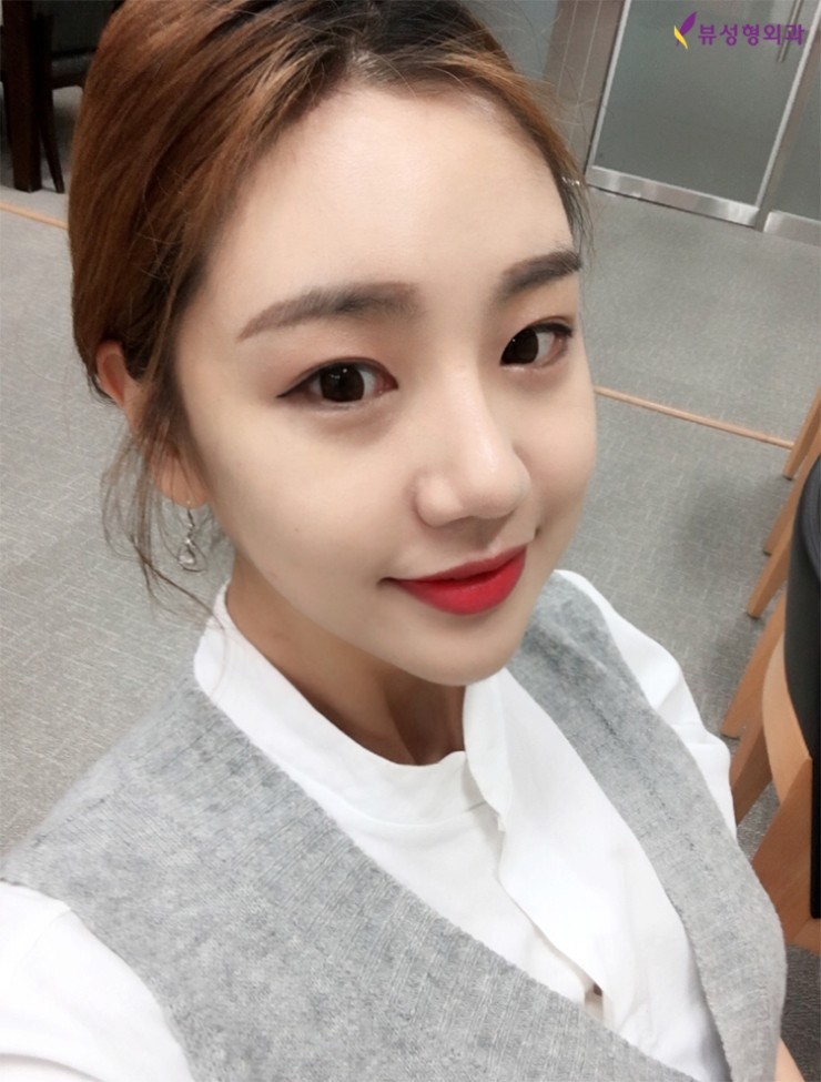 얼굴지방흡입 리프팅으로 V라인 제대로 잡자! 관련 이미지 6