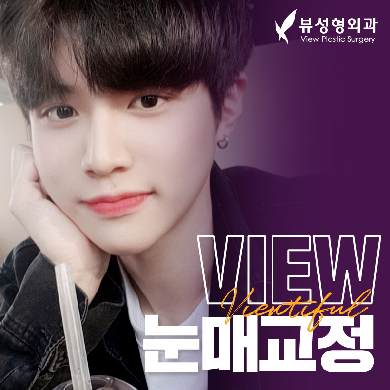 내게 맞는 눈성형을 위한 수술방법 관련 이미지 10