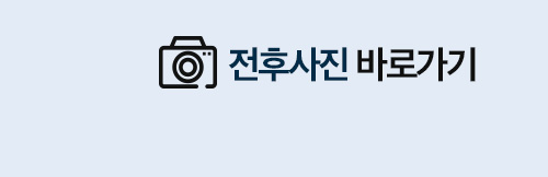 작고 이상적인 얼굴형을 위한 안면윤곽수술 관련 이미지 9