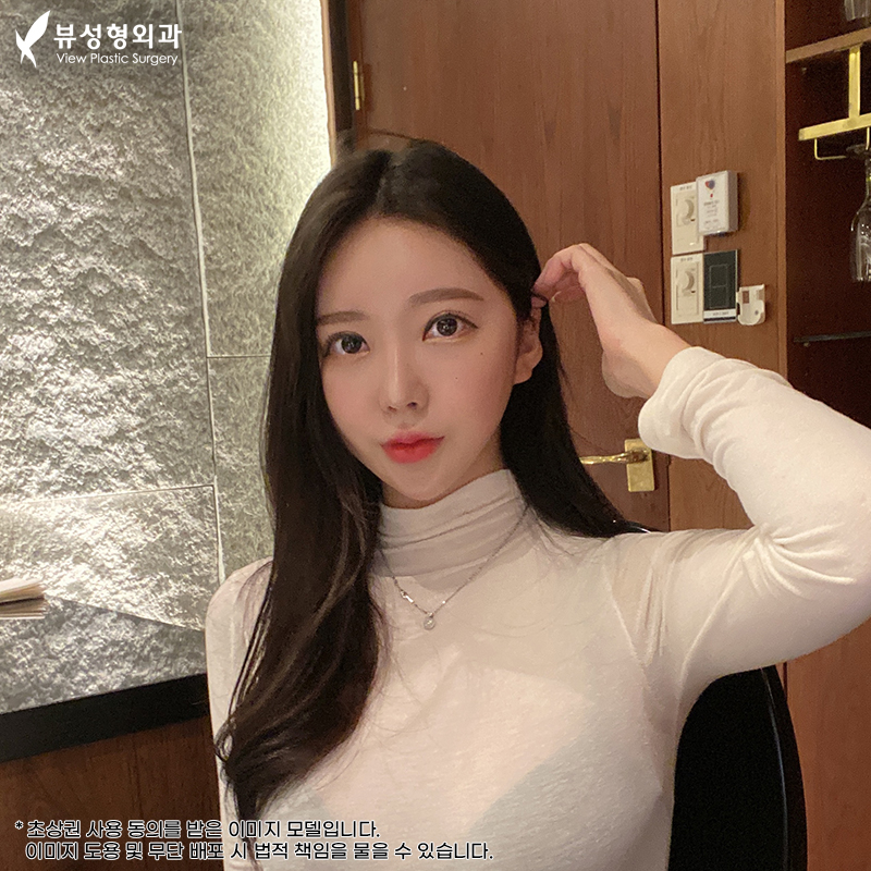 안면윤곽후기 뼈 상태를 위주로 관련 이미지 9