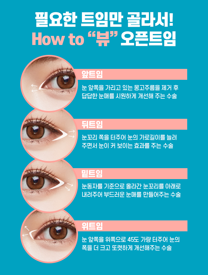 내게 맞는 눈성형을 위한 수술방법 알아보기 관련 이미지 8