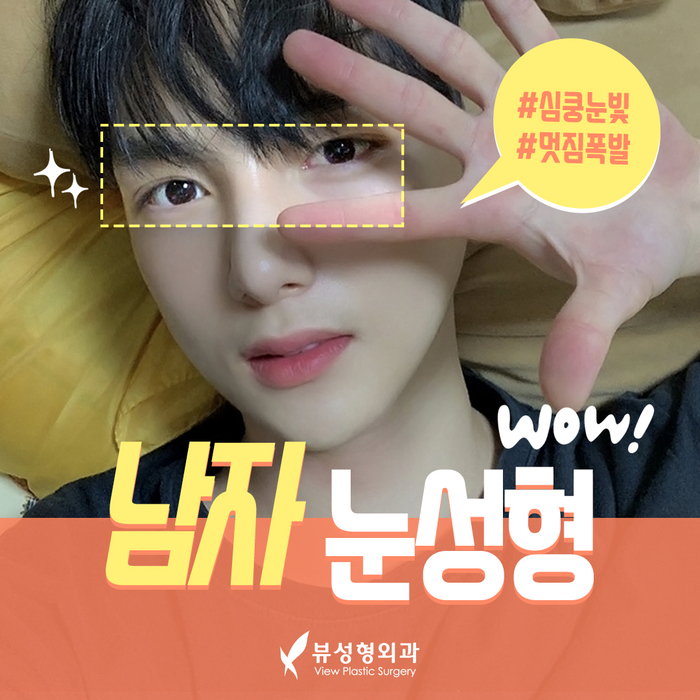 나만의 눈성형을 위한 수술방법 알아보기 관련 이미지 14