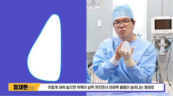 가슴성형 모양과 촉감은 기본, 안전은 필수! 관련 이미지 6