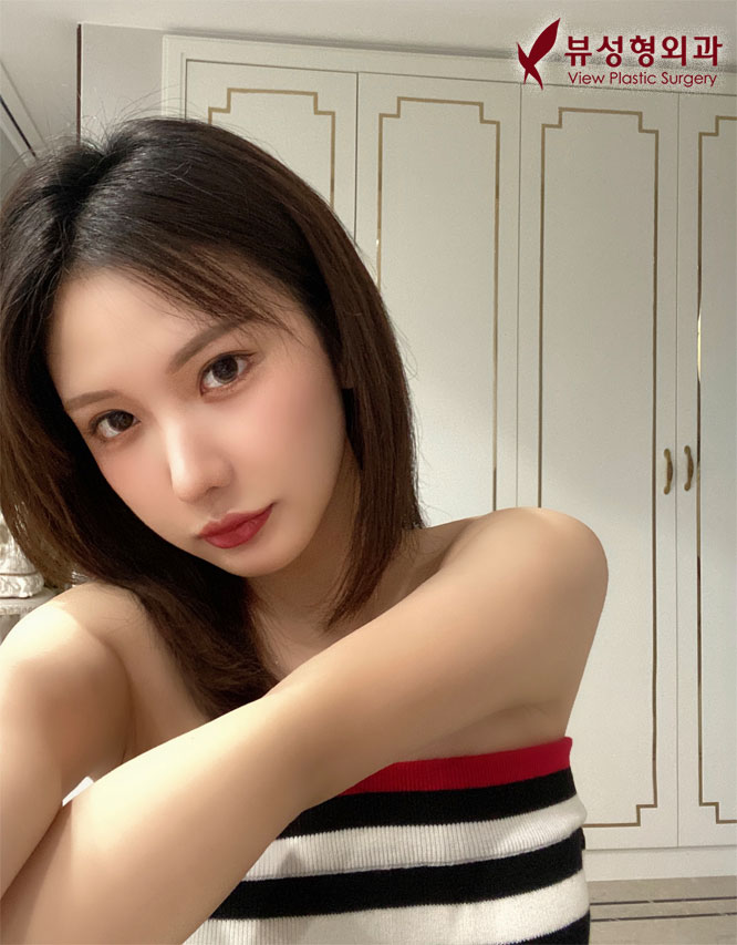 쌍꺼풀수술잘하는병원 알아보고 있다면 관련 이미지 7