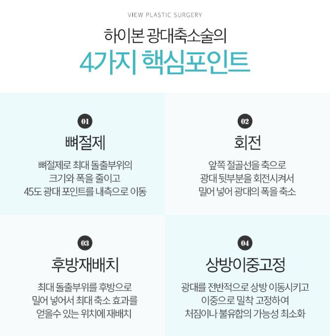 옆광대축소 작은얼굴 바란다면 관련 이미지 5
