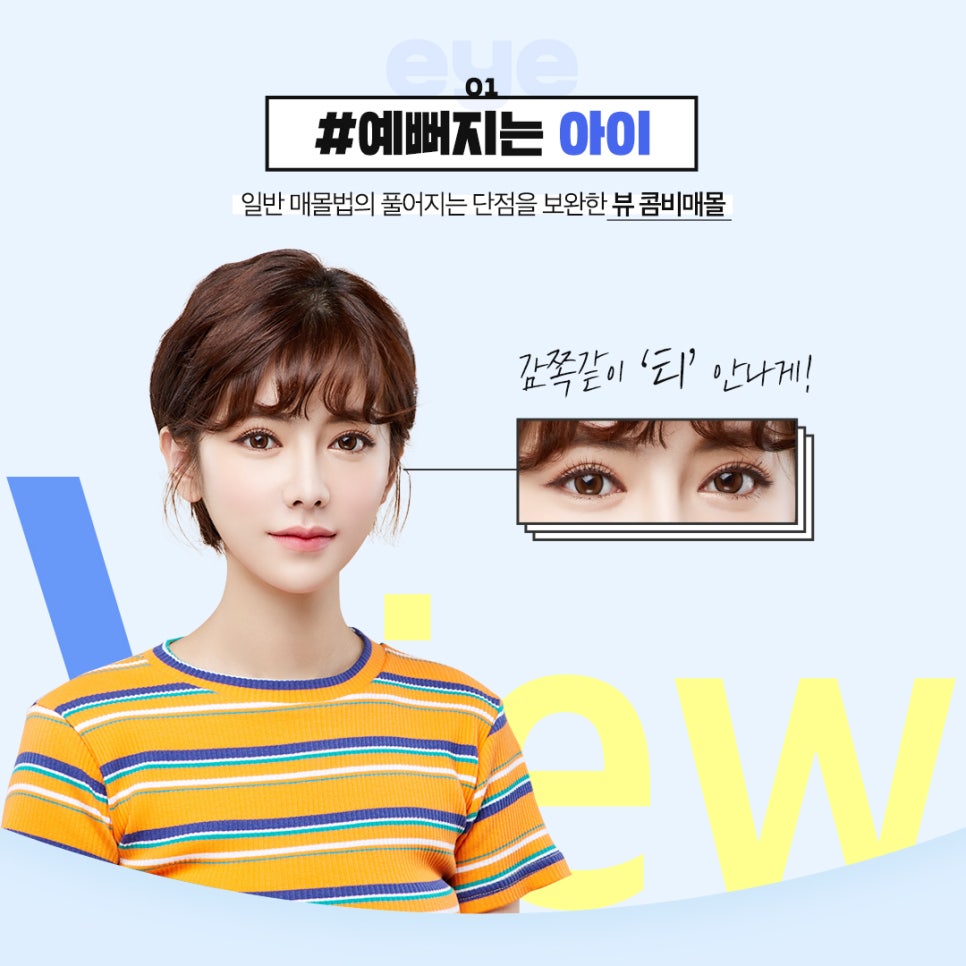 ☆여름 맞이 빠르게 찾아온 뷰성형외과 눈성형 이벤트☆ 관련 이미지 3